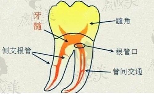 解答牙髓炎是怎么引起的,表现症状有哪些,怎么快速缓解疼痛