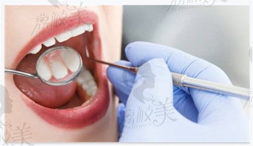 黔东南口腔医院收费标准发布,2023~2024种牙正畸补牙不贵