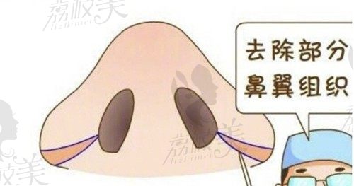 上海鼻尖整形医院排名，上海鼻尖整形排名前十医院及医生介绍
