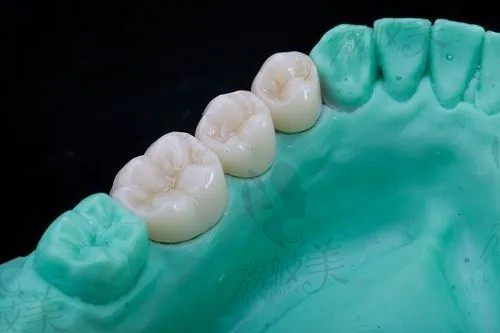 2023汕尾口腔医院价格表:矫正牙齿6k种植牙3k起收费挺合理