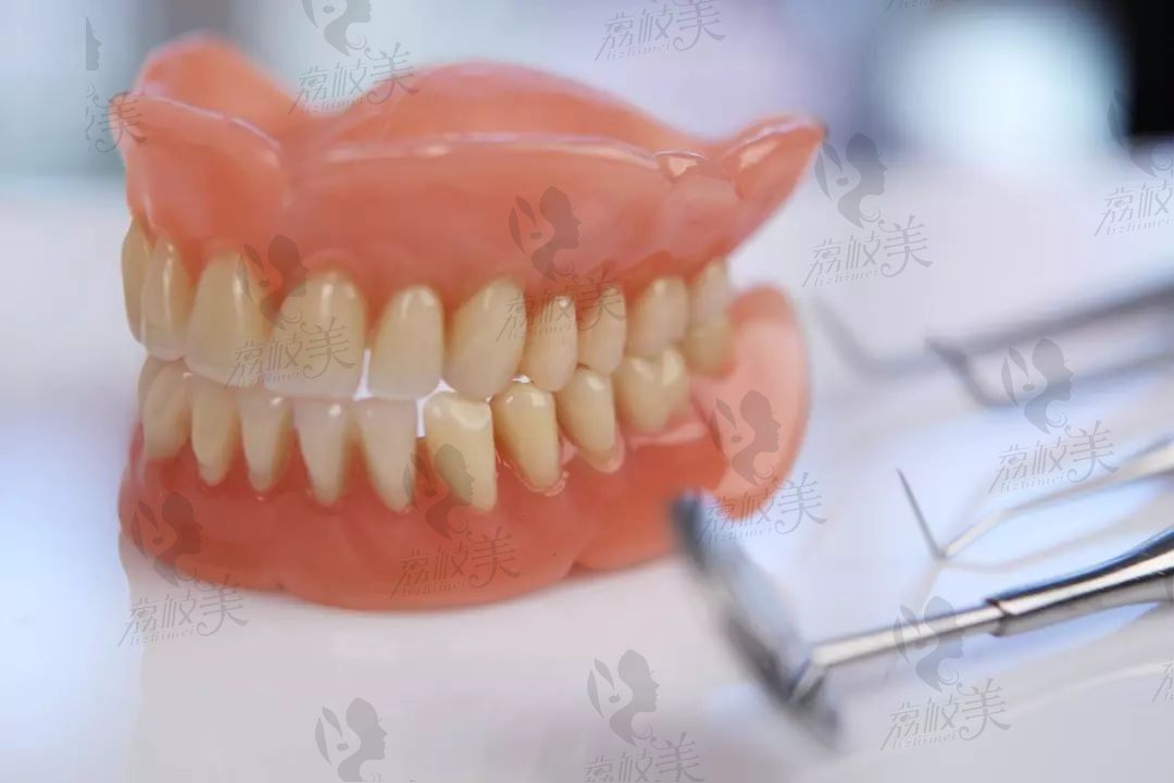 吸附性义齿是什么材料做的?掌握全瓷or树脂材质优缺点就明白