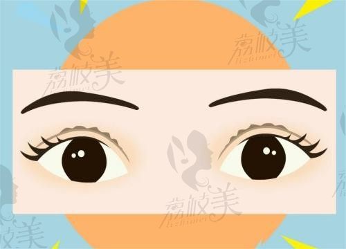 杭州双眼皮修复最好的整形医院排名，还有双眼皮修复最好的医生推荐