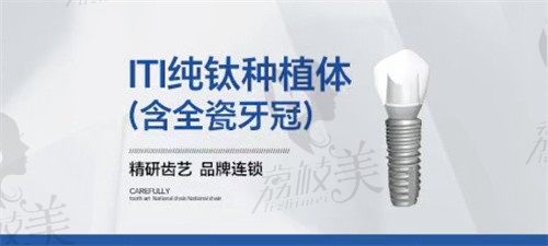 郑州拜尔口腔种植牙价格公开:瑞士ITI纯钛高端种植牙7500起