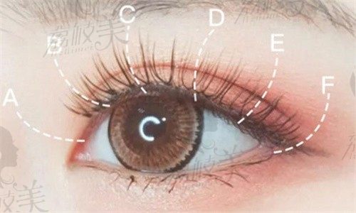 西安高一生割双眼皮口碑医生推荐，含眼综合价格及手术特色分析