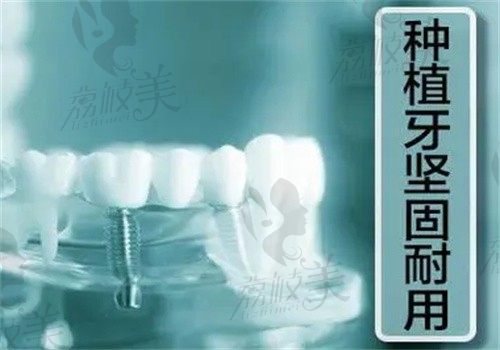 从手术难度、植体设计以及术后护理三方面来了解种植牙上牙和下牙有什么不同