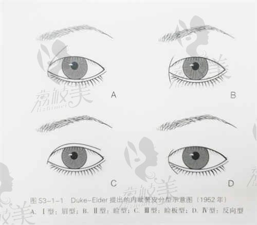 揭秘郑州第二中医院整形科仝晓医生在双眼皮手术项目的独特技艺和手法