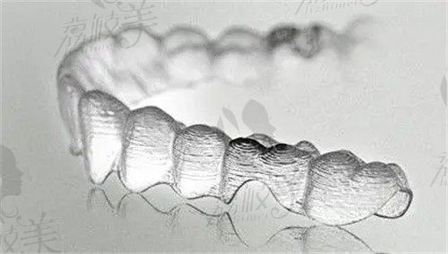 透明牙套矫正牙齿真的有效果吗？医生为你解析优势与注意事项
