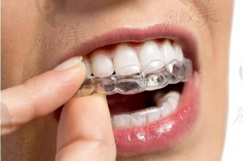 2023西宁牙齿矫正医院排名前十：包揽西宁牙齿矫正价目表实惠可信