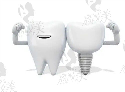 绵阳医博口腔医院种植牙怎么样？从评价中可看出在医博看牙不坑人