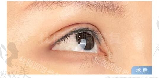 2024上海内（外）眼角修复专家名单：涵盖上海最出名的眼部整形医生