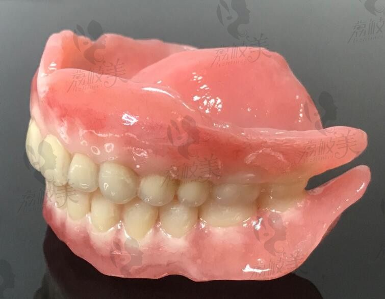 BPS吸附性义齿和普通义齿的区别：价格/优缺点/使用时长差异大