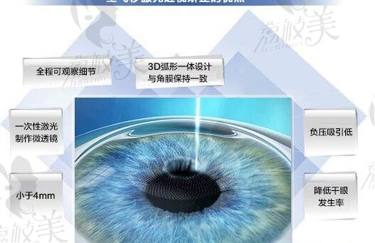 北京爱尔英智眼科与同仁眼科：技术实力、服务质量、价格收费全面对比解析