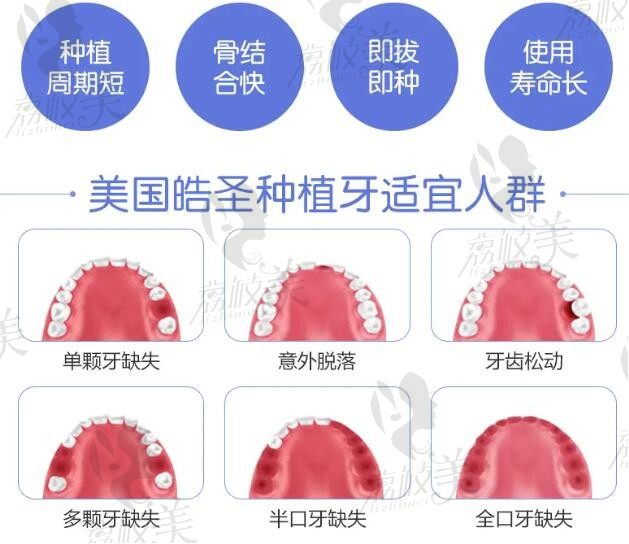 韩国奥齿泰和美国皓圣哪个好？是属于什么档次的植体价格多少钱