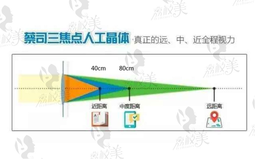 拿出蔡司人工晶体型号对照表，看看15种型号的价格及特点是什么