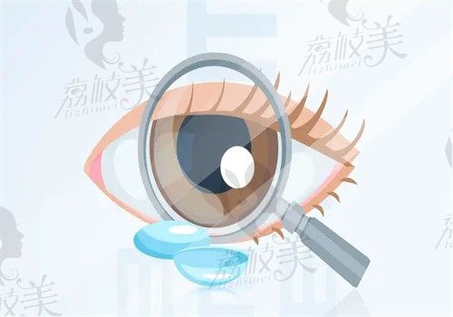 角膜塑形镜和ok镜是一样的,可临时性矫正近视/散光等视力问题