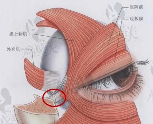 功课郑永生教授跟杜园园谁厉害？都是修复双眼皮的十大专家技术案例对比