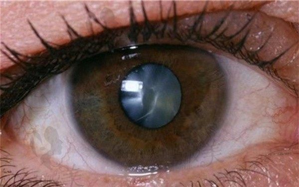 武汉悦瞳眼科门诊部远视手术技术可靠，附加项目价格收费