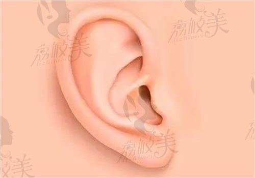 20岁的我终于鼓起勇气把畸形的耳朵整了，安波博士耳再造技术就是靠谱
