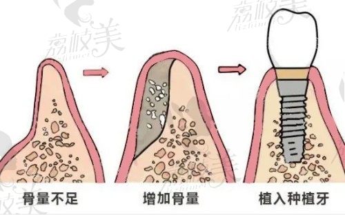 视神经萎缩有办法治疗吗？