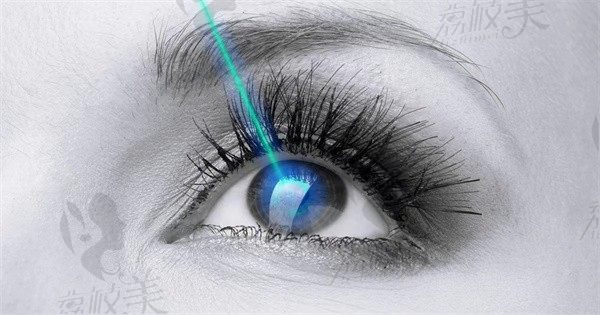 全激光是什么样的近视手术？优势在哪里？