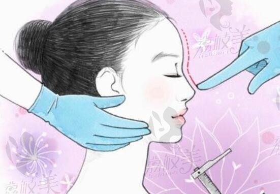 在韩国EG童颜医院做了妈生鼻后，脸部立体度上升了N层