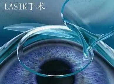 何氏眼科总院地址在哪里？做近视眼矫正价格贵吗 附收费一览表