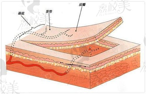 北京八大处疤痕修复科怎么样？八大处疤痕医生名单及价格一览表