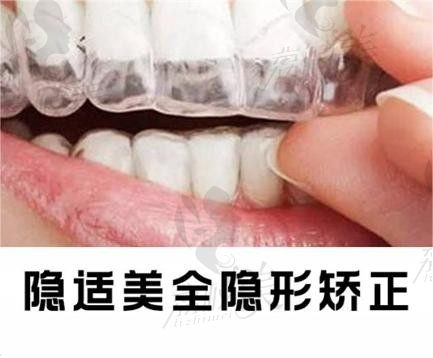 重庆牙博士口腔牙齿矫正价格不贵,隐适美矫正3.6W起美观又舒适