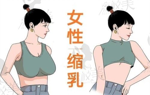 西安缩胸手术较好的医院和医生登场,公办和私立巨乳缩小手术医院排名齐刷刷上线