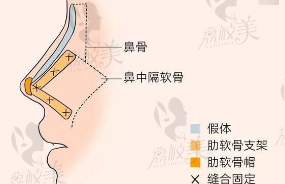 成都鼻修复哪个医生做的好？推荐段焘/邓东伟/周珂技术口碑双高