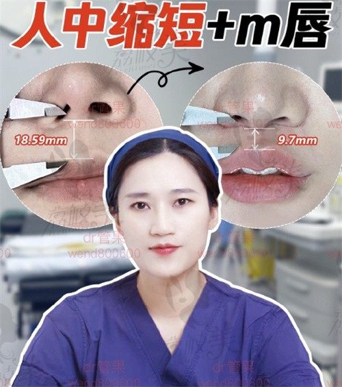 管果在上海沪西医院坐诊,管果主要是做双眼修复和人中缩短很不错