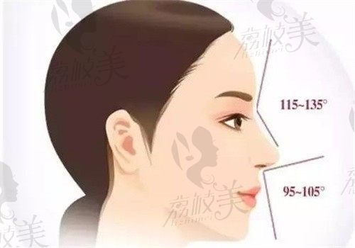 哈尔滨瑞丽杨永胜案例分享，花2万多做鼻修复自然精致技术很不错