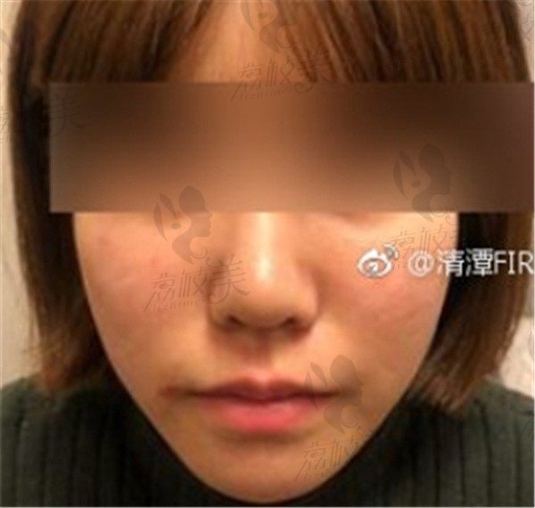 手术前