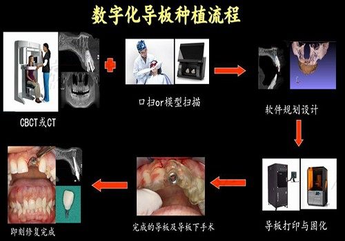 广州德伦口腔是三甲吗？是收费不贵的连锁医院看牙很正规 附电话