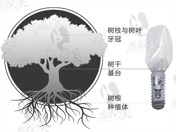 种植牙两年后牙龈发炎，来看看发炎什么症状又要如何进行治疗及预防