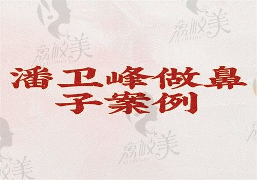 潘卫峰做鼻子案例汇总,可知道做鼻子怎么样有价格和预约挂号方式