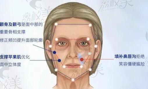 鄭康在磨骨怎么樣極致嗎？一般是屬于什么風(fēng)格的呢如何預(yù)約掛號(hào)？