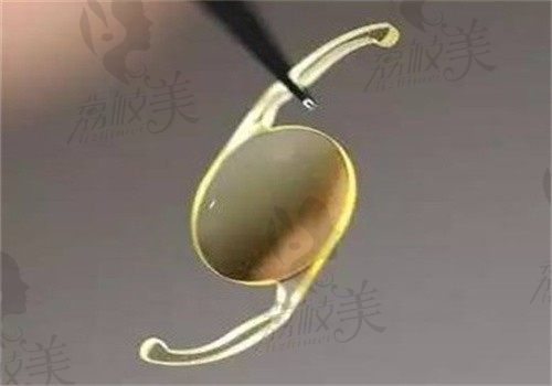 渭南白水眼科医院孙梅做三焦点人工晶体2.2w起，微创手术恢复快