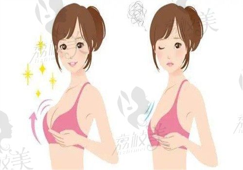 广州美恩许扬滨缩胸价格35800起，巨乳缩小技术好成效显著