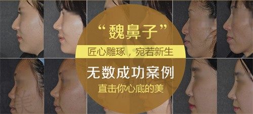 韩国隆鼻失败修复哪家医院好?will/优雅人/id都受韩国人认可