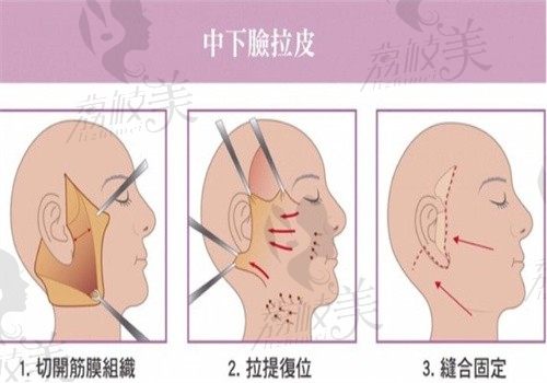 王冀耕技术如何？个人资料简介显示小切口提升技术好价格不贵