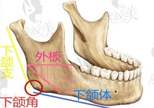 广州韩妃柳超磨骨很不错，花6W多颧骨颧弓内推+截骨手术拥有精致小脸