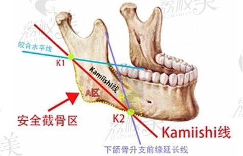 罗延平磨骨三件套价格52000元起，就在广州广大出诊十分注重细节