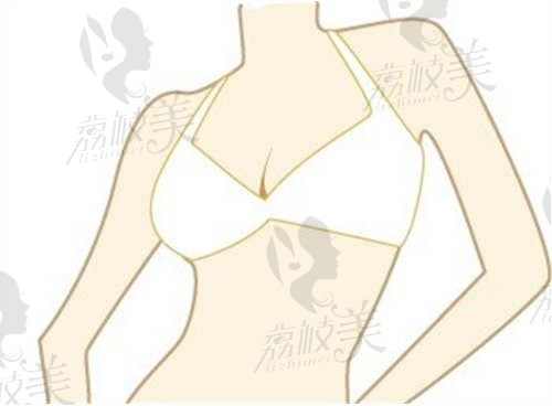 廣州唐志榮隆胸口碑怎么樣？乳房界的大師，假體不位移下垂自然還很逼真