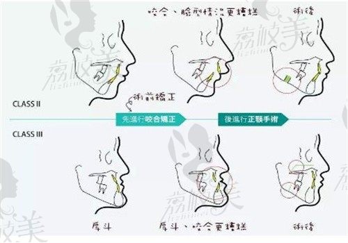 重慶王濤正頜怎么樣?