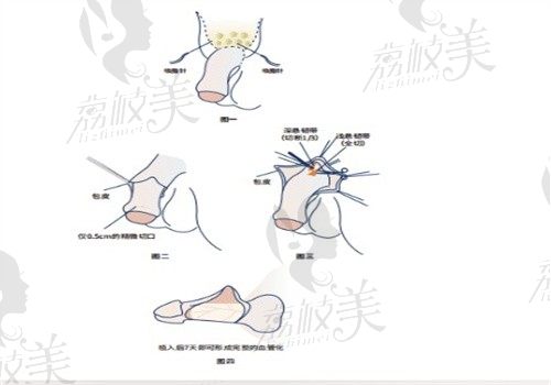 李世荣医生厉害吗?从李世荣简介看擅长男性增粗/延长手术