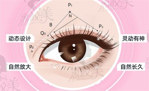 佛山美莱王燕医生简介显示她做眼睛技术好，钓系美人眼4800起