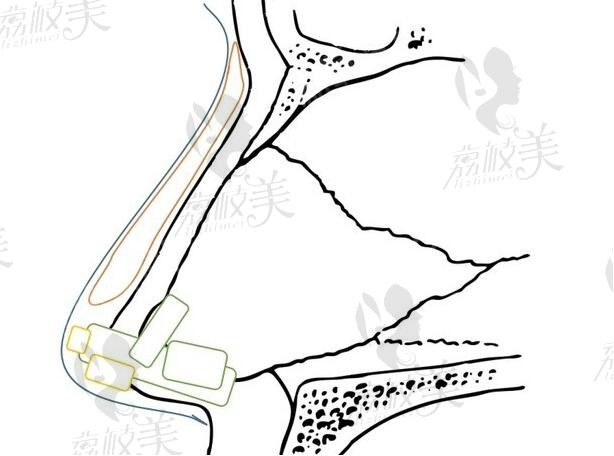 鄧柏林做鼻子怎么樣？醫(yī)生簡(jiǎn)歷顯示鄧柏林擅長(zhǎng)鼻整形收費(fèi)在3W~6W+