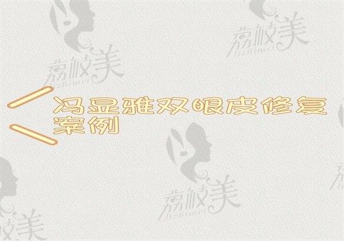 冯显雅双眼皮修复案例汇总：价格1.8万—9.8万起技术贼好可预约