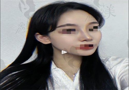 手术后